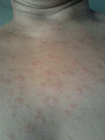 img 20160718 wa0000 largejpg